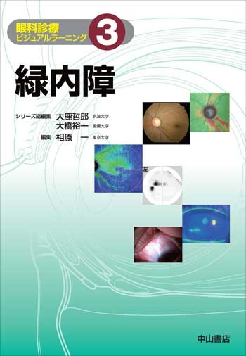 3　緑内障 1560
