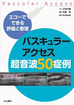 エコーでできる評価と管理　バスキュラーアクセス超音波50症例 1593