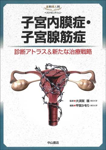 子宮内膜症・子宮腺筋症－診断アトラス＆新たな治療戦略－ 1651