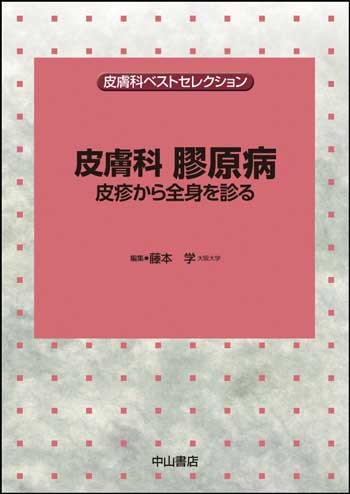 皮膚科 膠原病－皮疹から全身を診る 1656