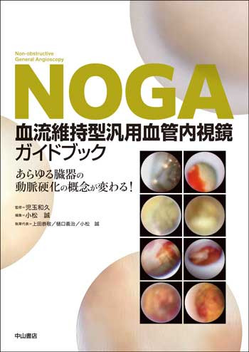 NOGA血流維持型汎用血管内視鏡ガイドブック 1682