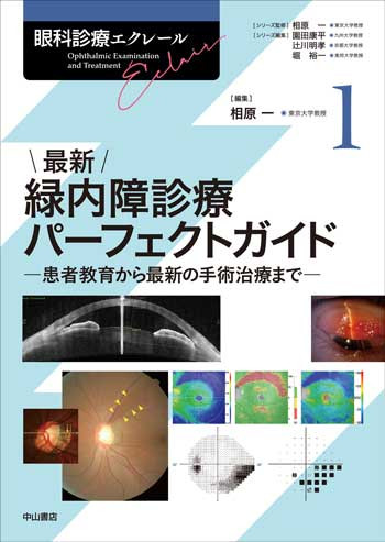 最新 緑内障診療パーフェクトガイド－患者教育から最新の手術治療まで 1718