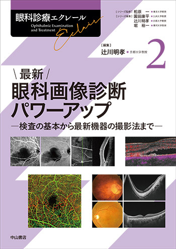 最新 眼科画像診断パワーアップ－検査の基本から最新機器の撮影法まで 1722