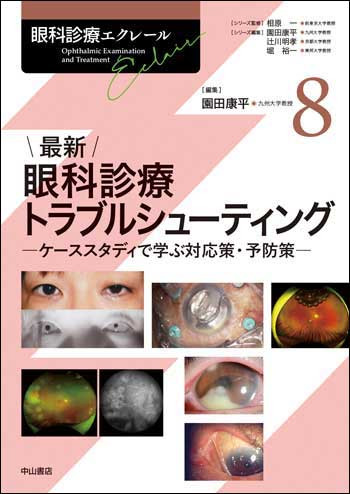最新 眼科診療トラブルシューティング 1763