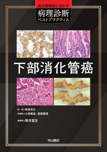 下部消化管癌 1759