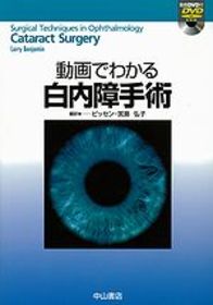 動画でわかる白内障手術 1011