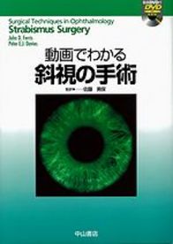 動画でわかる斜視の手術 1024