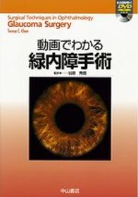 動画でわかる緑内障手術 1039