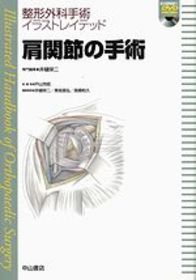 肩関節の手術 1126