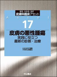 17　皮膚の悪性腫瘍　実践に役立つ最新の診断・治療 1366